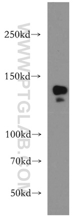 CTR9 Antibody in Western Blot (WB)