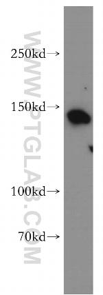 CTR9 Antibody in Western Blot (WB)