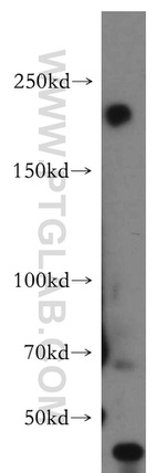 RB1CC1 Antibody in Western Blot (WB)