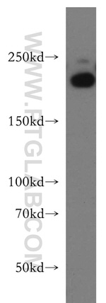 RB1CC1 Antibody in Western Blot (WB)