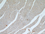 WBSCR17 Antibody in Immunohistochemistry (Paraffin) (IHC (P))