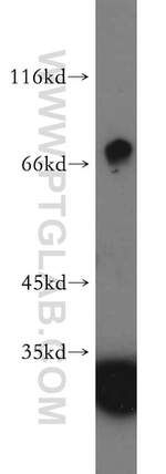 WBSCR17 Antibody in Western Blot (WB)