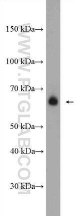 WBSCR17 Antibody in Western Blot (WB)