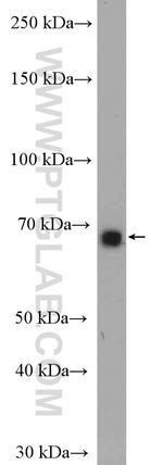 WBSCR17 Antibody in Western Blot (WB)