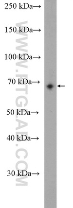 WBSCR17 Antibody in Western Blot (WB)