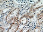 MOGAT2 Antibody in Immunohistochemistry (Paraffin) (IHC (P))