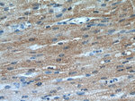 SMYD2 Antibody in Immunohistochemistry (Paraffin) (IHC (P))