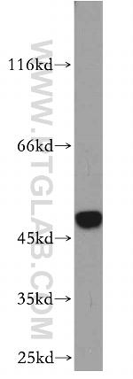 SMYD2 Antibody in Western Blot (WB)