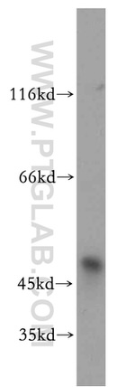 SMYD2 Antibody in Western Blot (WB)