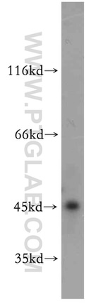 SMYD2 Antibody in Western Blot (WB)