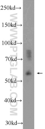 MANEA Antibody in Western Blot (WB)