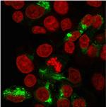 Albumin (Transport Protein) Antibody in Immunocytochemistry (ICC/IF)