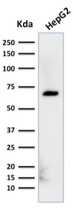 Albumin (Transport Protein) Antibody in Western Blot (WB)