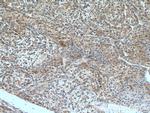 GTSE1 Antibody in Immunohistochemistry (Paraffin) (IHC (P))