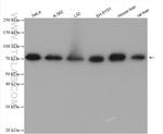 GTSE1 Antibody in Western Blot (WB)