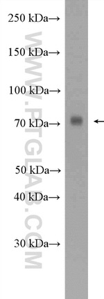 GTSE1 Antibody in Western Blot (WB)