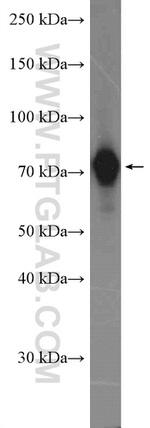 GTSE1 Antibody in Western Blot (WB)