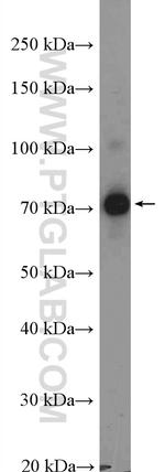 GTSE1 Antibody in Western Blot (WB)