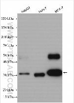 Cathepsin D Antibody in Western Blot (WB)