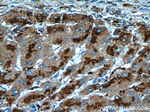 Cathepsin D Antibody in Immunohistochemistry (Paraffin) (IHC (P))