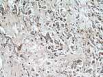 Cathepsin D Antibody in Immunohistochemistry (Paraffin) (IHC (P))