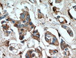 Cathepsin D Antibody in Immunohistochemistry (Paraffin) (IHC (P))