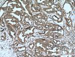 Cathepsin D Antibody in Immunohistochemistry (Paraffin) (IHC (P))