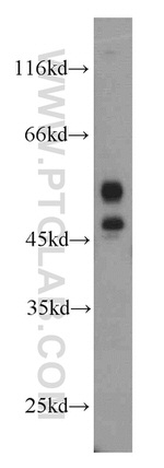 Cathepsin D Antibody in Western Blot (WB)