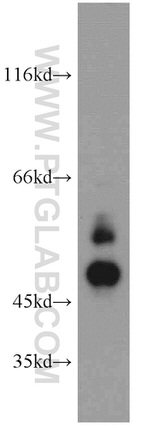 Cathepsin D Antibody in Western Blot (WB)