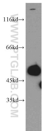 Cathepsin D Antibody in Western Blot (WB)