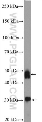 Cathepsin D Antibody in Western Blot (WB)