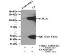 C3/C3b/C3c Antibody in Immunoprecipitation (IP)