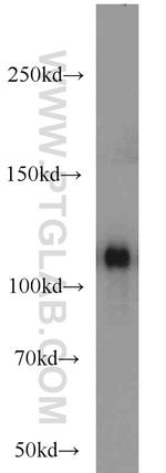 C3/C3b/C3c Antibody in Western Blot (WB)