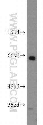 Sestrin 2 Antibody in Western Blot (WB)