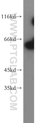 Sestrin 2 Antibody in Western Blot (WB)