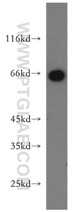 Sestrin 2 Antibody in Western Blot (WB)