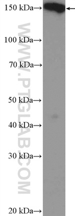 PLCB3 Antibody in Western Blot (WB)