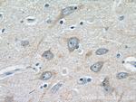 CHRNA7 Antibody in Immunohistochemistry (Paraffin) (IHC (P))