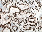 Pan-PAX Antibody in Immunohistochemistry (Paraffin) (IHC (P))