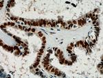 Pan-PAX Antibody in Immunohistochemistry (Paraffin) (IHC (P))