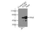 Pan-PAX Antibody in Immunoprecipitation (IP)