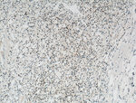 Pan-PAX Antibody in Immunohistochemistry (Paraffin) (IHC (P))