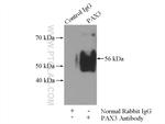 PAX3 Antibody in Immunoprecipitation (IP)