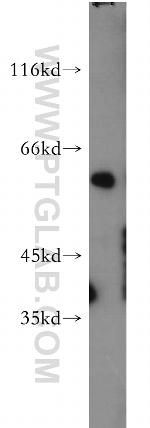 PAX3 Antibody in Western Blot (WB)