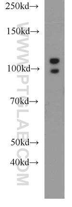 ALDH1L2 Antibody in Western Blot (WB)