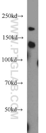 KIAA1602 Antibody in Western Blot (WB)