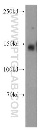 KIAA1602 Antibody in Western Blot (WB)