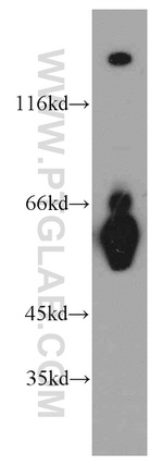 RNF168 Antibody in Western Blot (WB)