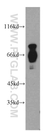 RNF168 Antibody in Western Blot (WB)