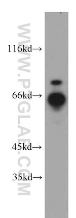 RNF168 Antibody in Western Blot (WB)